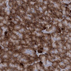 C2GNT3 Antibody, Novus Biologicals 0.1mL; Unlabeled:Antibodies, Polyclonal